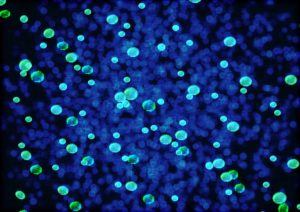 UV light with bacteria